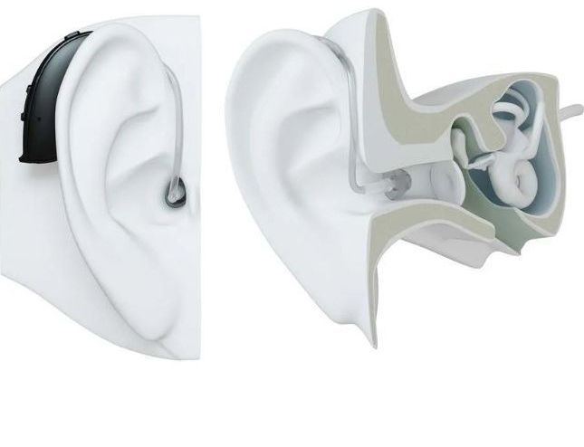 ReSound Behind the ear hearing Aid
