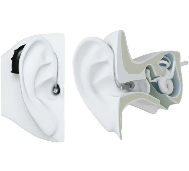 ReSound Reciver in Canal (RIC) Hearing Aid