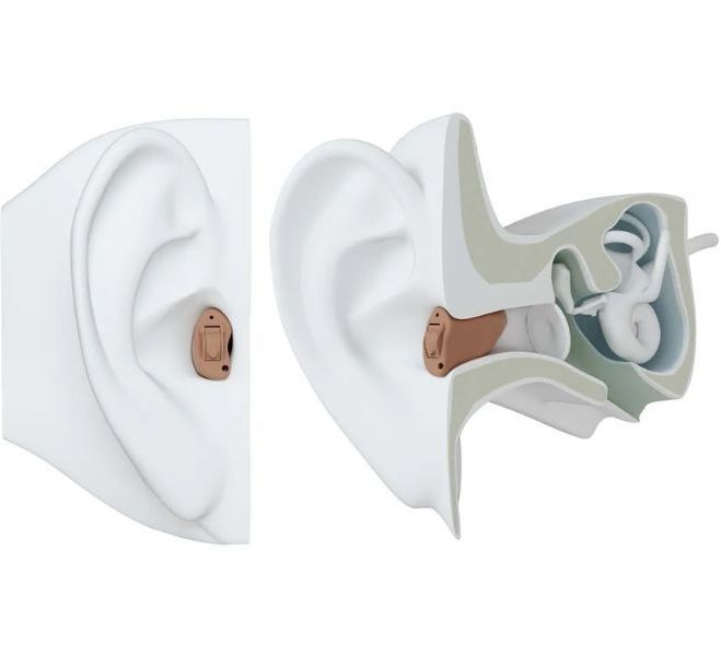 ReSound In-the-canal (ITC) Hearing Aid