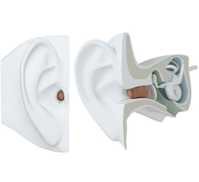 ReSound CIC Hearing Aids (CIC) Hearing Aid