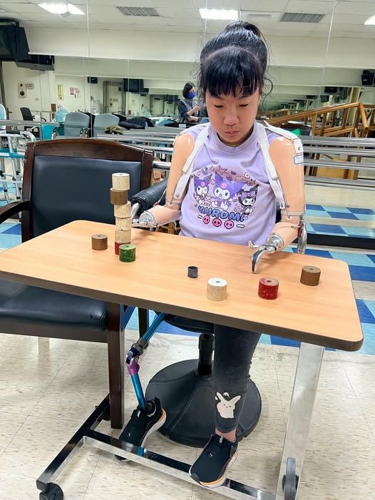 弱勢補助計畫實景：一名穿著紫色上衣的女孩在練習使用上肢義肢，展現平價義肢方案協助傷友重拾生活自理能力的過程。