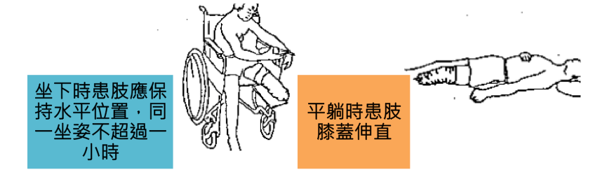術後正確姿勢教學：展示坐姿時患肢保持水平位置，以及平躺時殘肢膝蓋伸直的正確擺放方式，並輔以藍色與橘色圖說標示。
