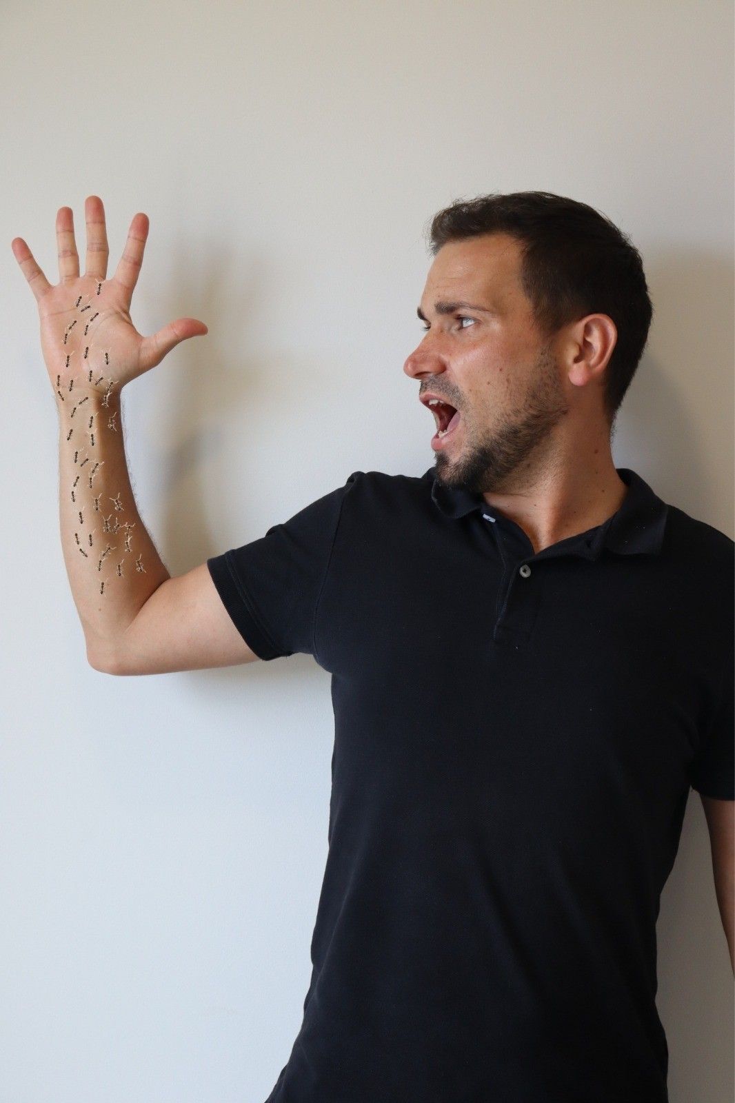 3 Main Anatomical Changes That Can Cause Pins and Needles in hands, pain in my hands, hand ache