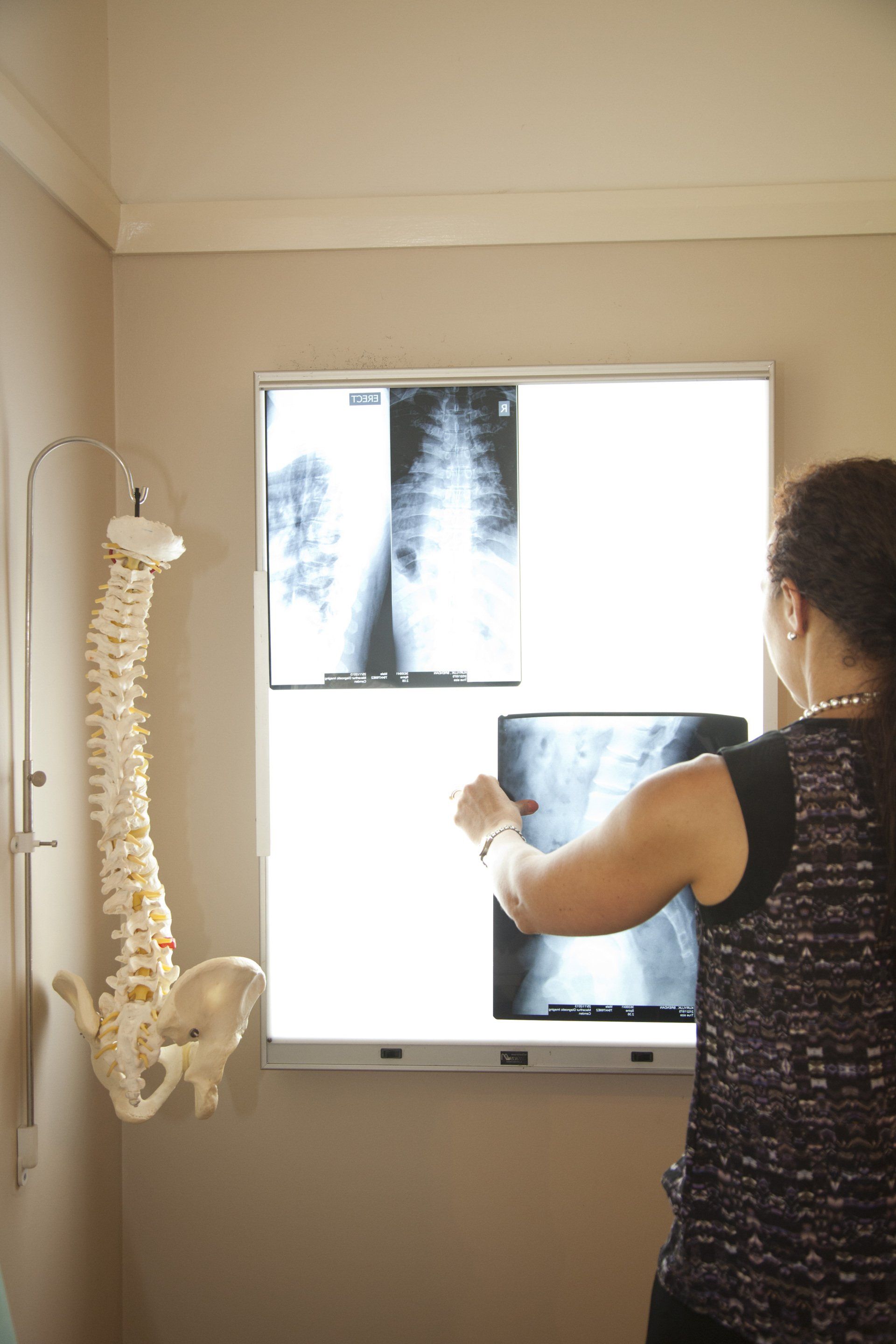 Chiropratic Checking the X-Ray Results — Camden, NSW — Vicki Patterson Chiropractic