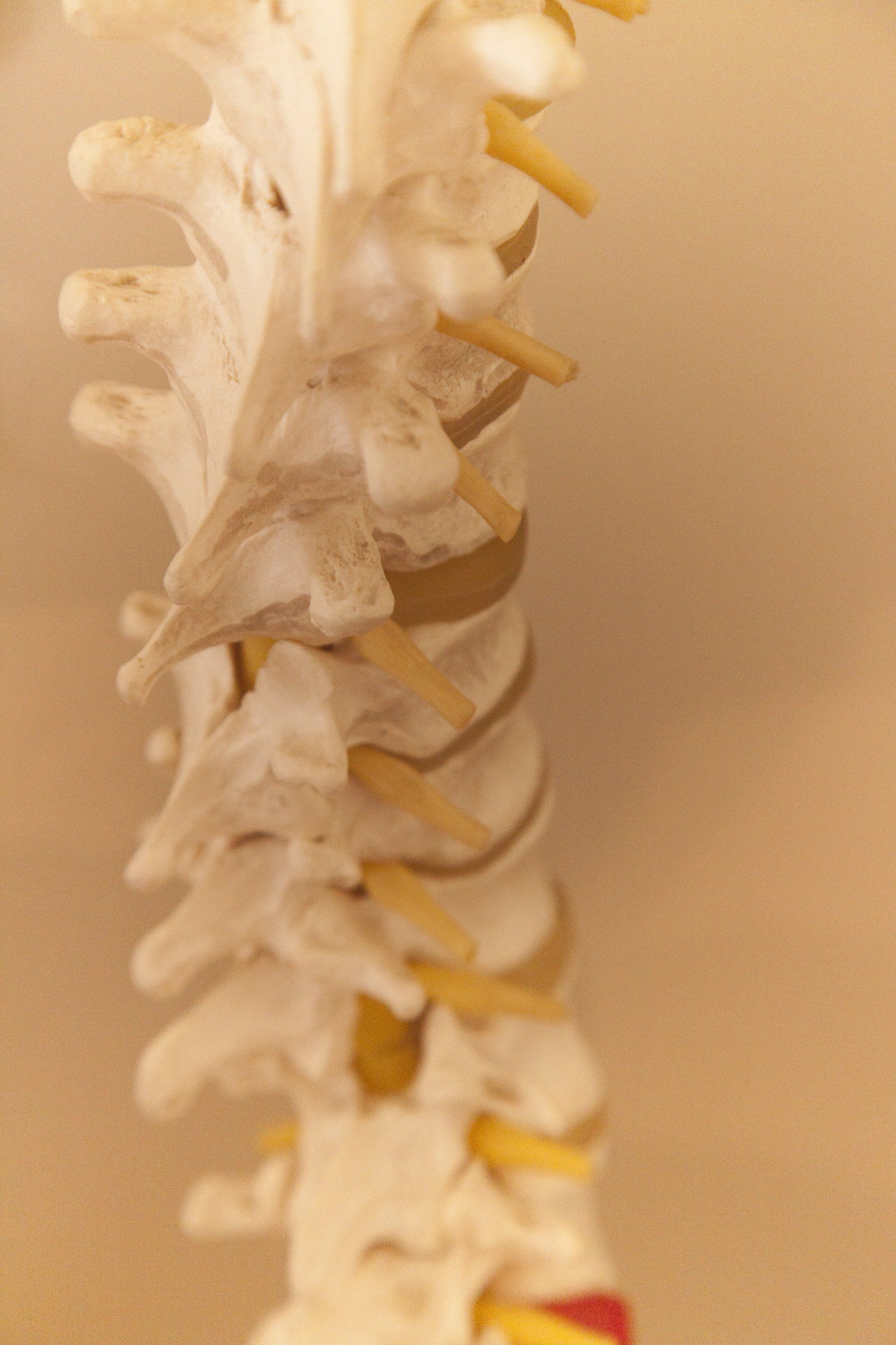 Spine Model — Camden, NSW — Vicki Patterson Chiropractic
