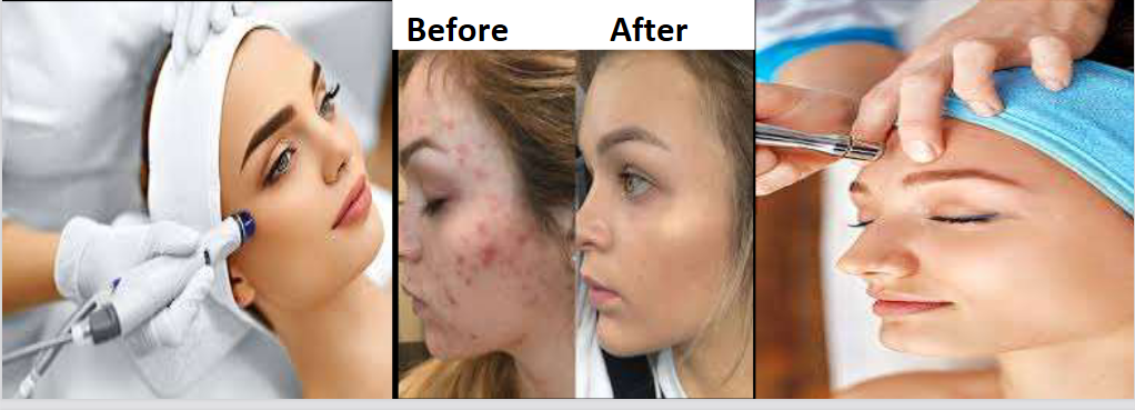 Before and after picture of beauty treatment