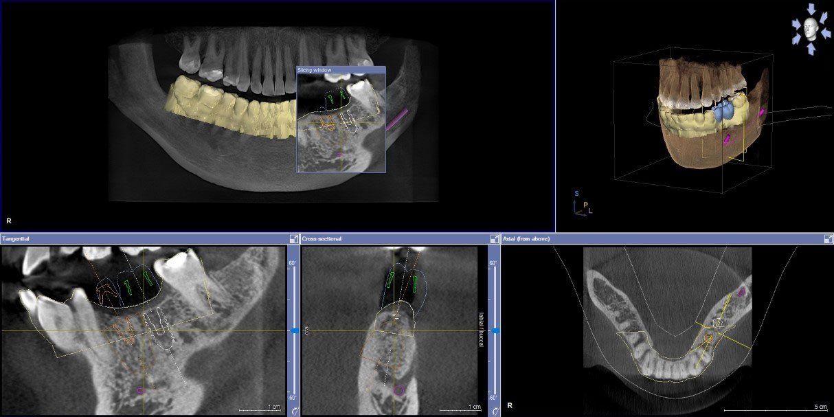 CBCT/3D Imaging - Christiana Pleasant Dental