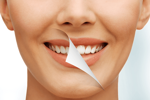 Teeth Whitening - Christiana Pleasant Dental
