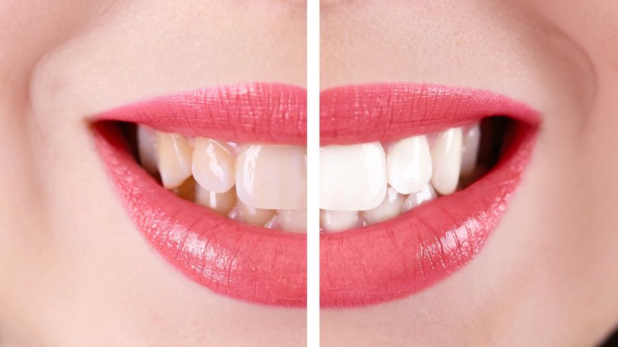 Primo piano di labbra sorridenti con rossetto rosa
