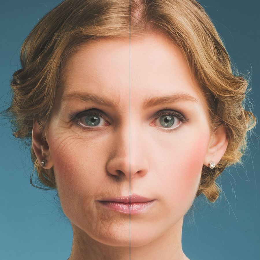 trattamenti anti aging
