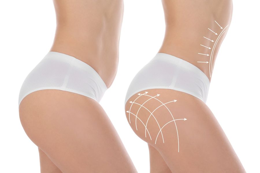 modellatura del corpo.