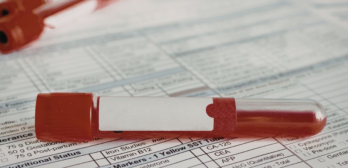 Red blood vial lying on a lab ordert document