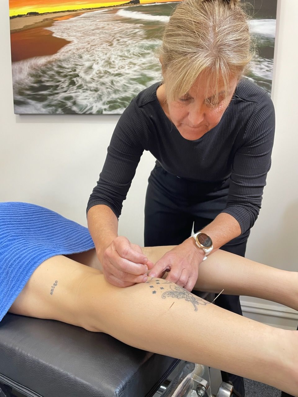 Trina dry needling and chiropractic