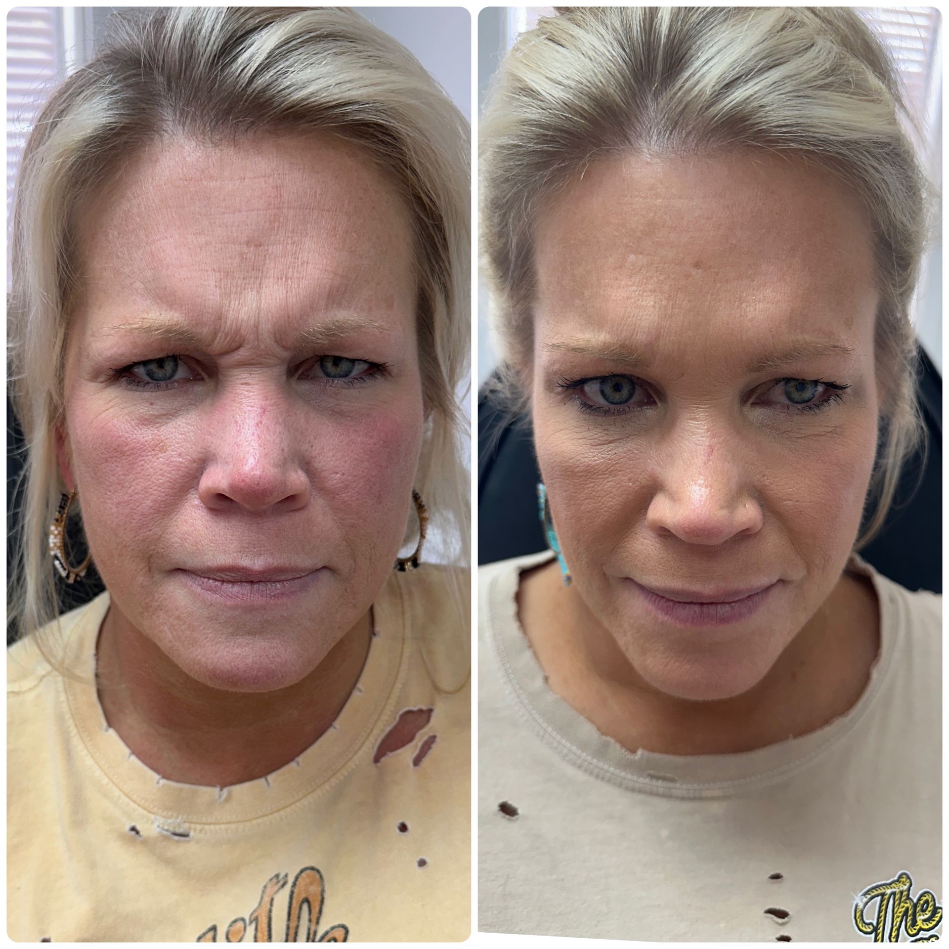 A before and after photo of a woman 's face