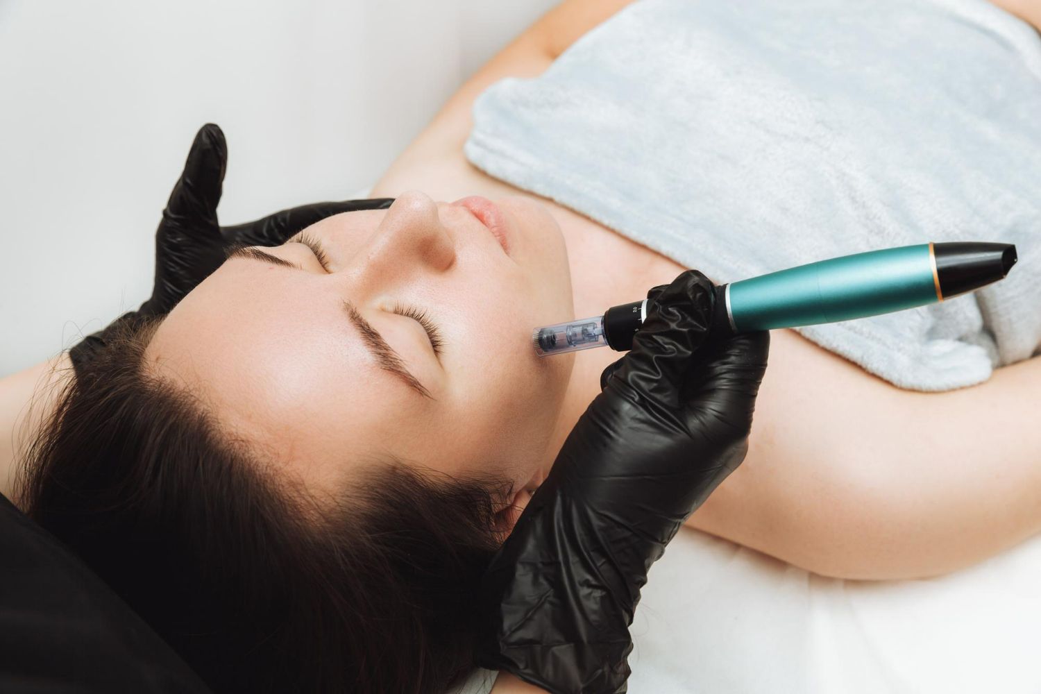 A woman is getting a microdermabrasion treatment on her face.