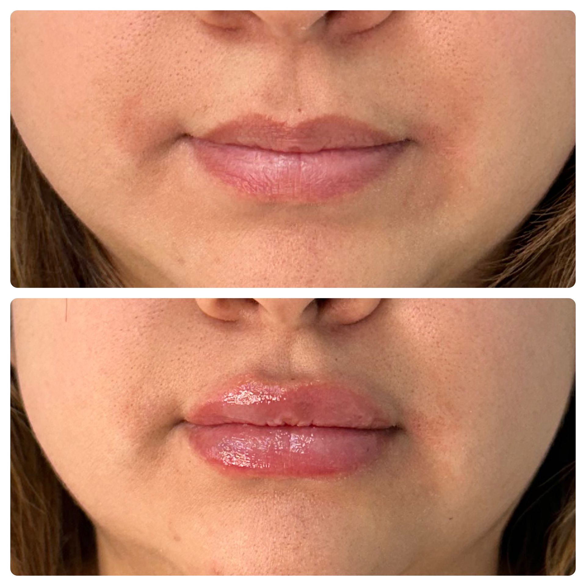 A before and after photo of a woman 's lips.