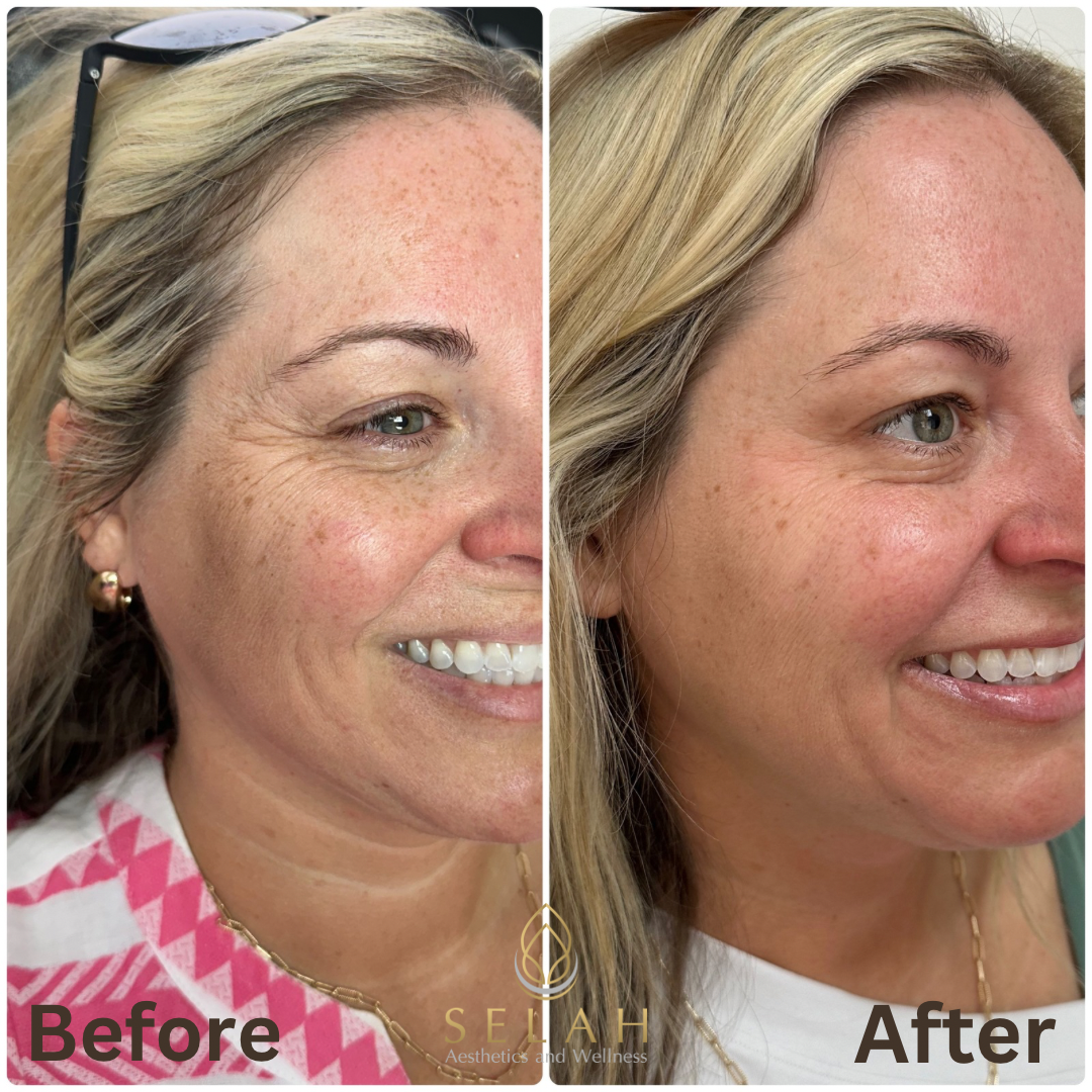 A before and after photo of a woman 's face.