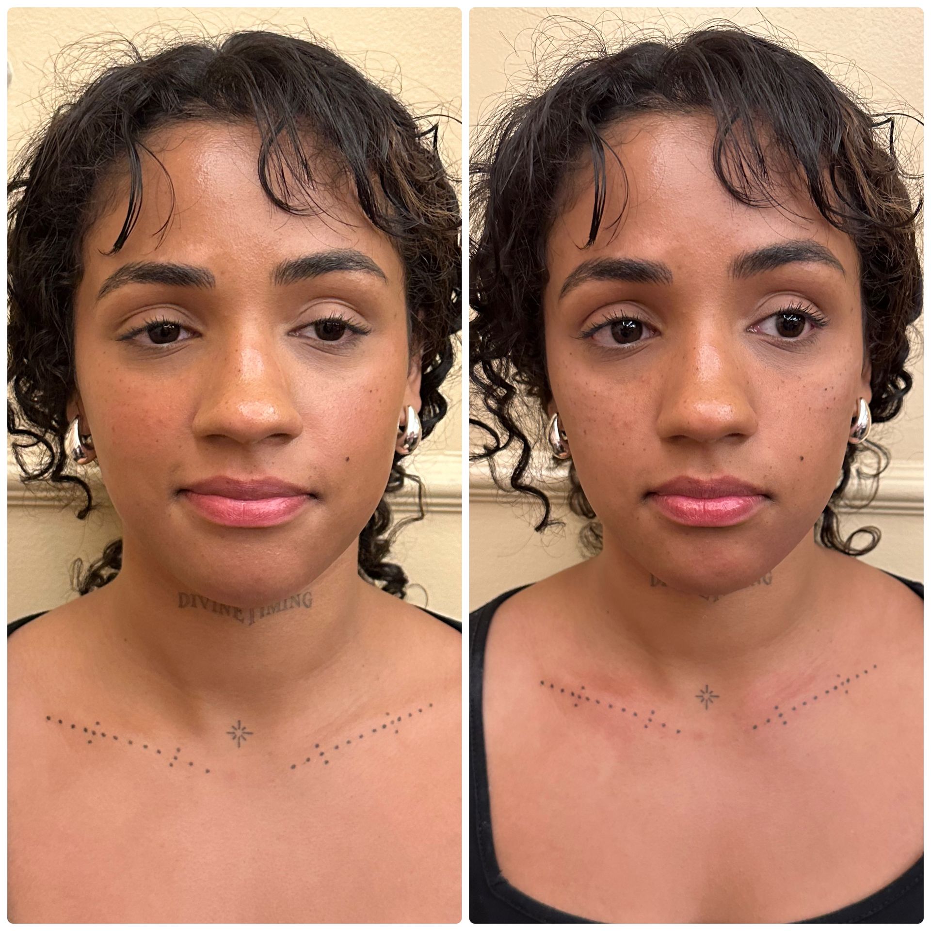 A before and after photo of a woman 's face