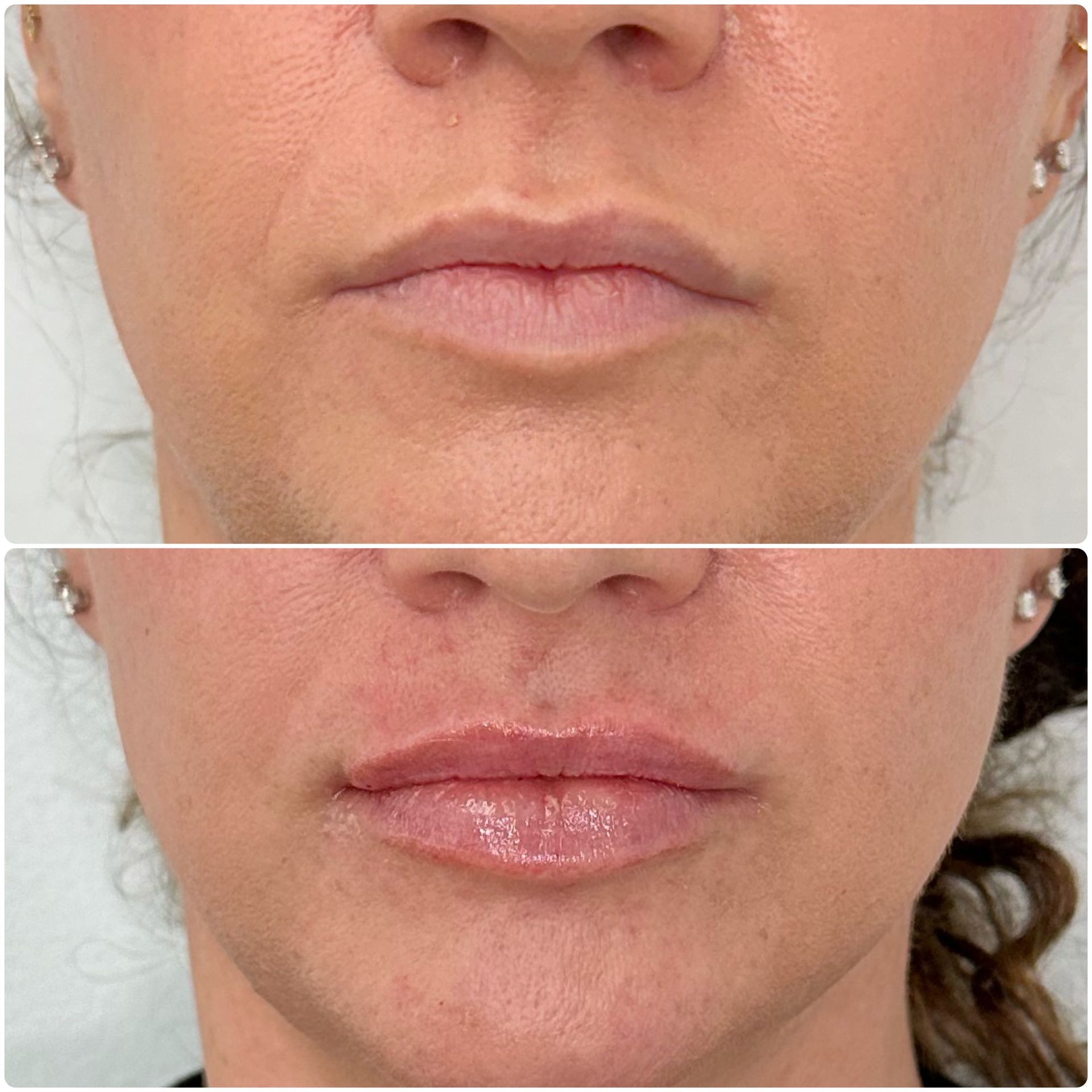 A before and after photo of a woman 's lips.