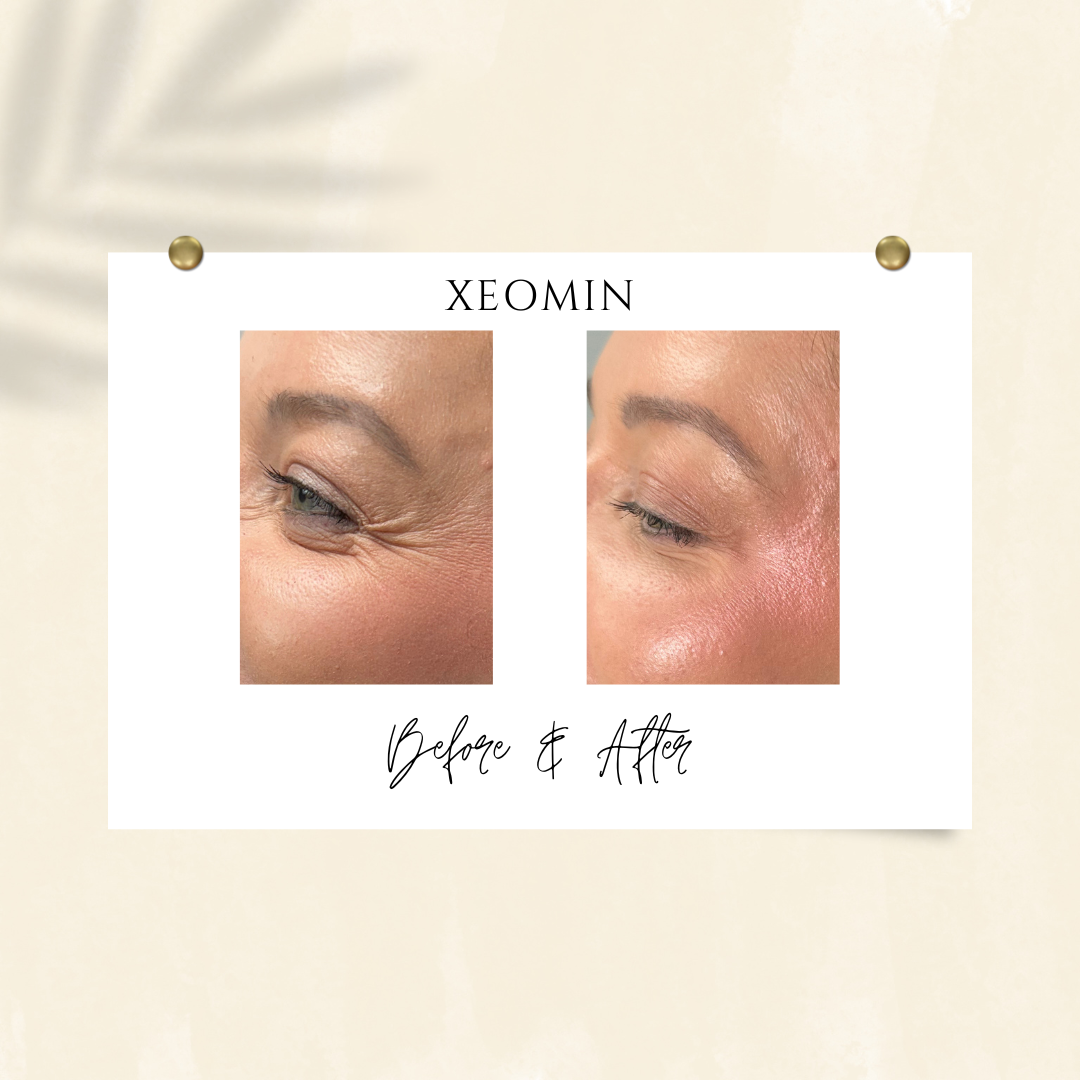 A before and after photo of a woman 's face.