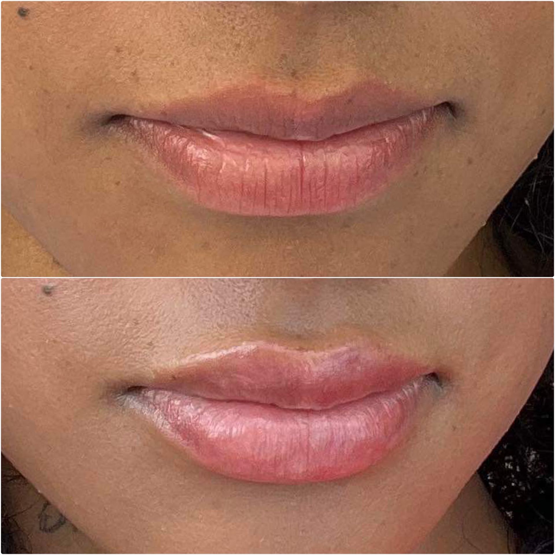 A before and after photo of a woman 's lips.