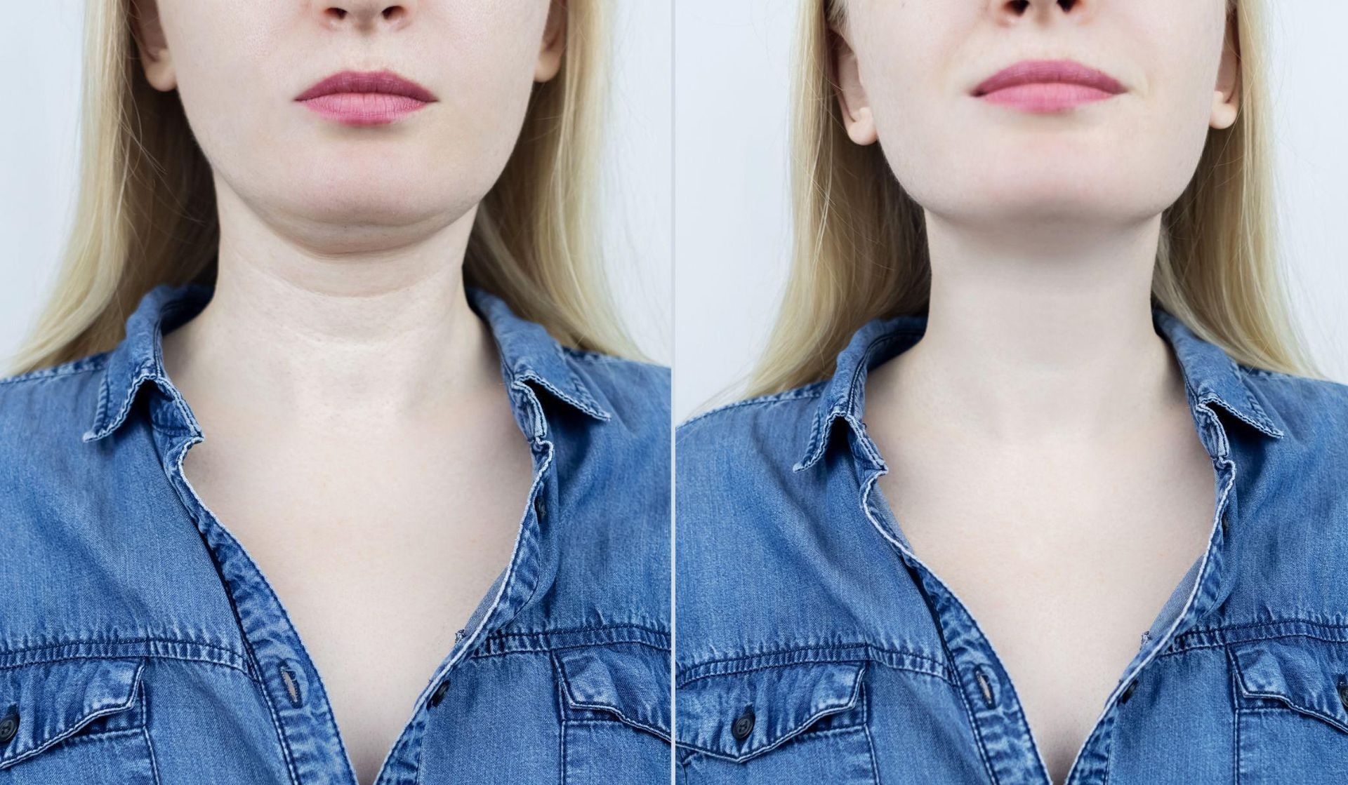 Proven Ways to Sculpt Your Shape With Injectable Body Contouring