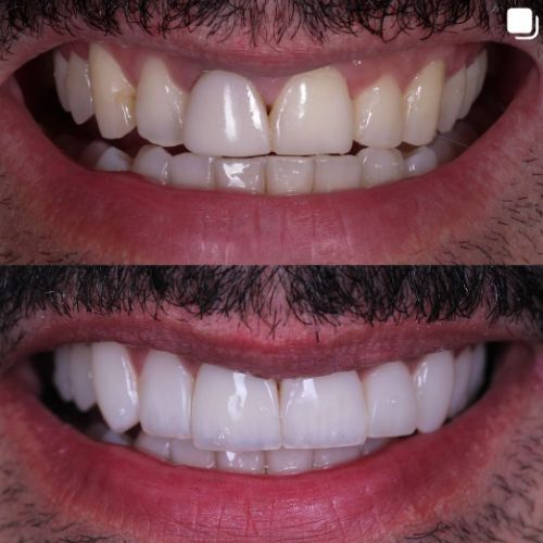 Imagem de uma paciente da Dra. Anna Leal - realizando os procedimento iniciais de uma cirurgia de  Cirurgia BucoMaxiloFacial