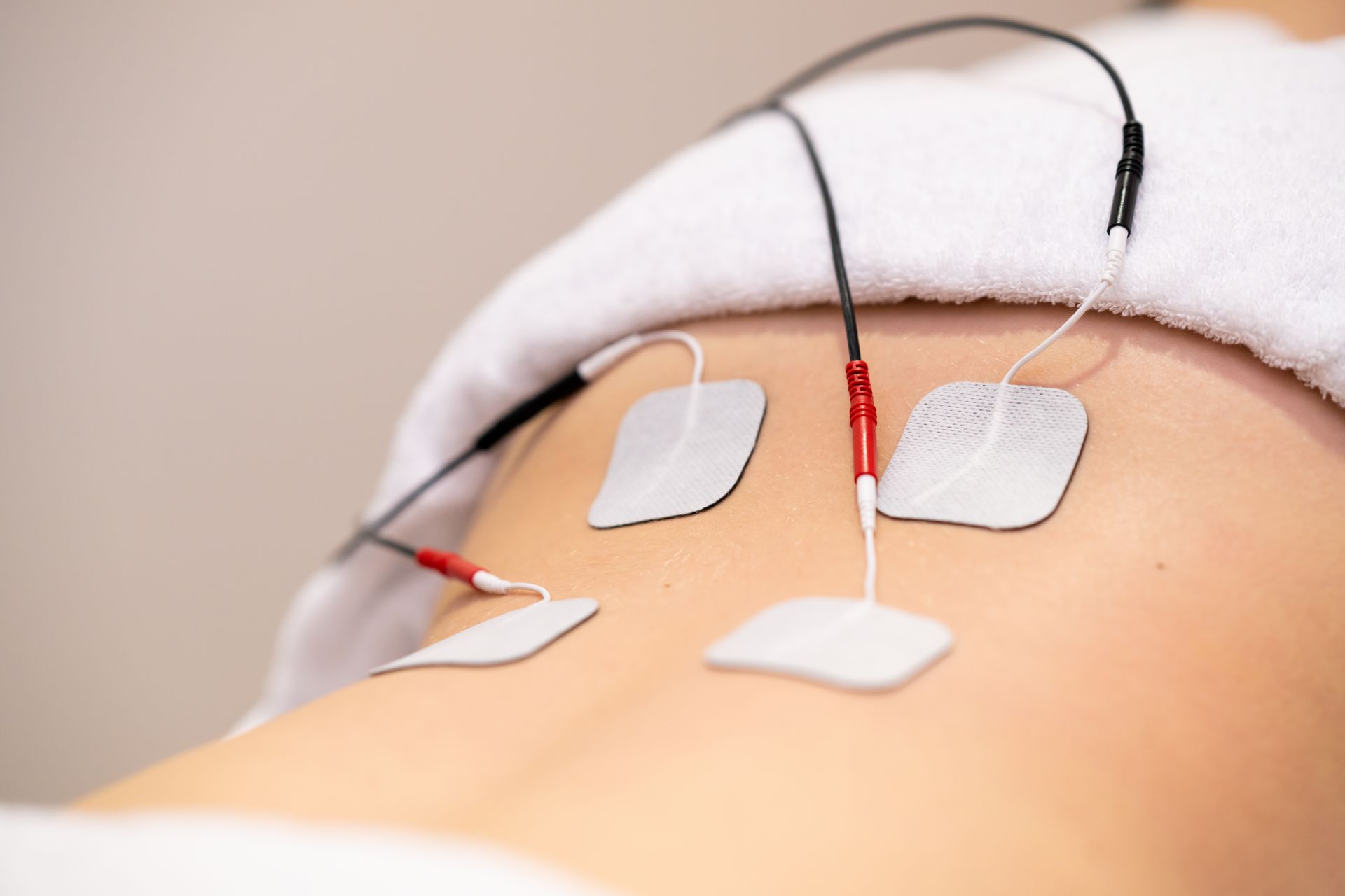 un primo piano di una persona che riceve un trattamento con elettrodi sulla schiena .