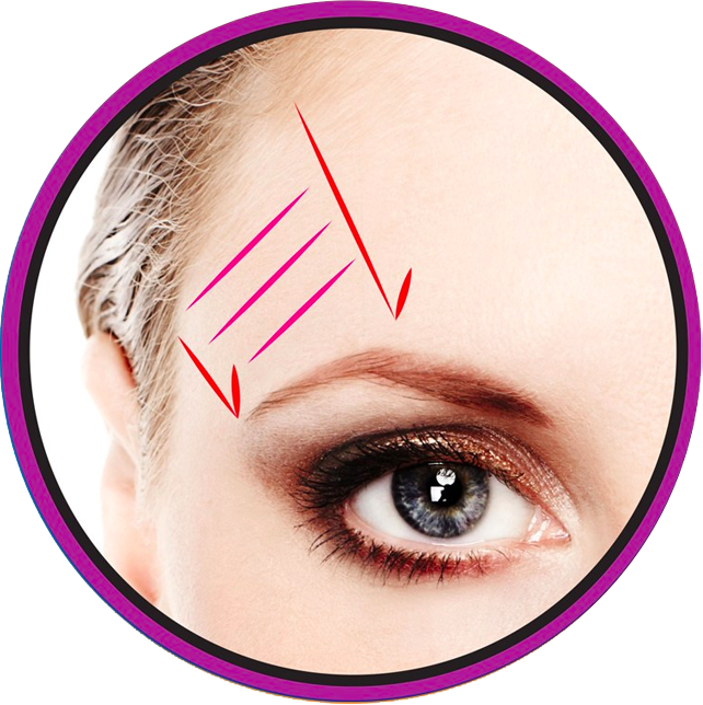 Eyebrow Lift procedure offered by Hot Springs Surgery and Vein in Hot Springs, AR