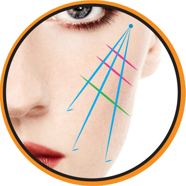Three Vector Cheek/Jowl  Lift procedure offered by Hot Springs Surgery and Vein in Hot Springs, AR
