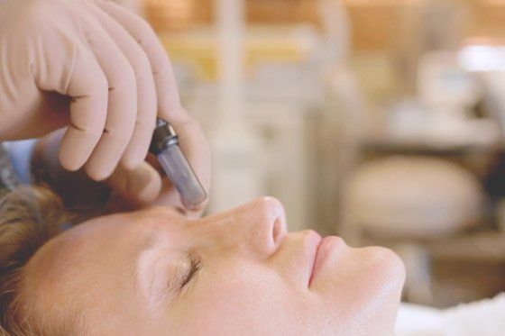 microneedling to perform collagen induction therapy in hot springs arkansas