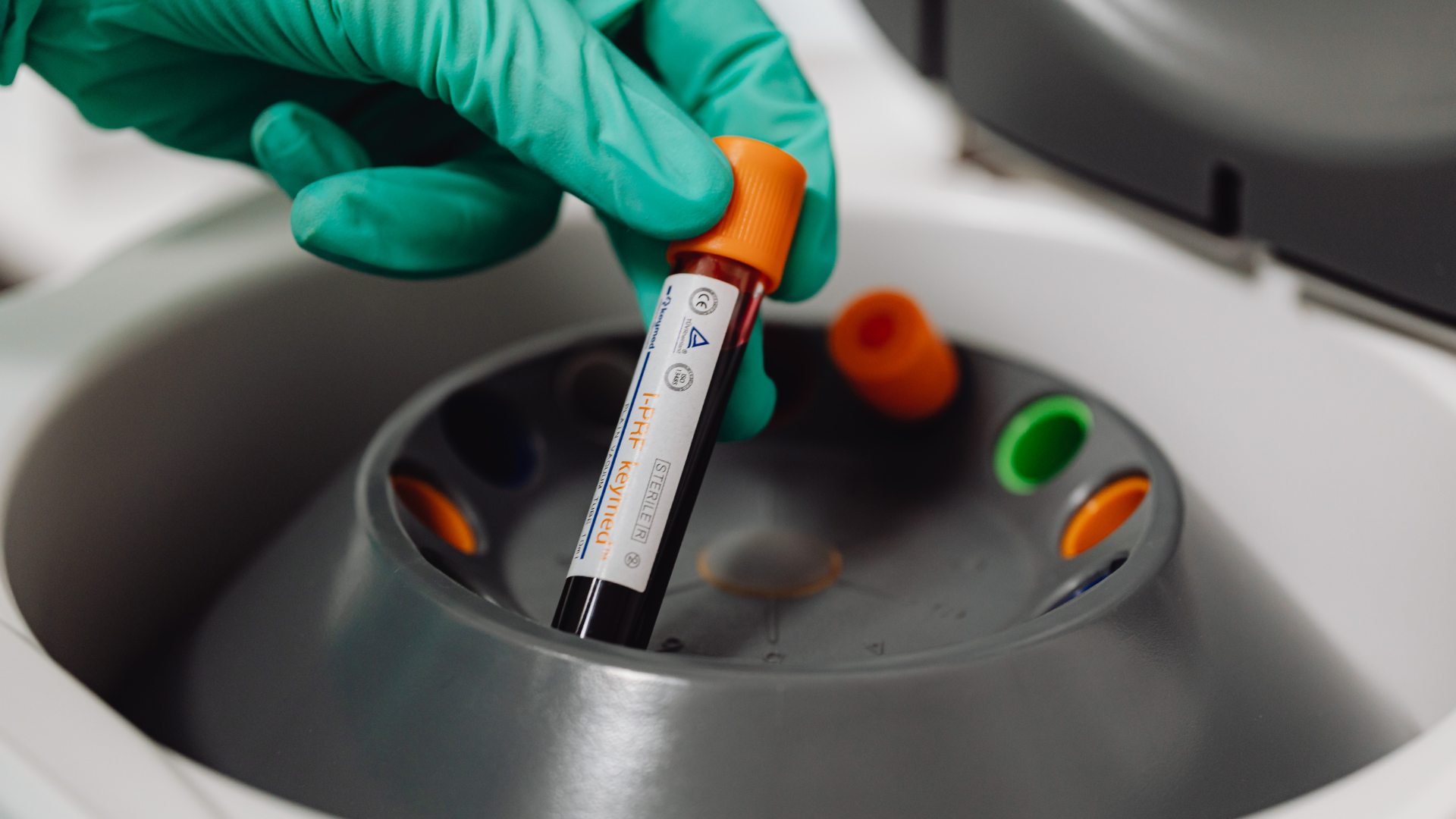 Gloved hand placing blood sample tube in a gray centrifuge. Tube has an orange cap.