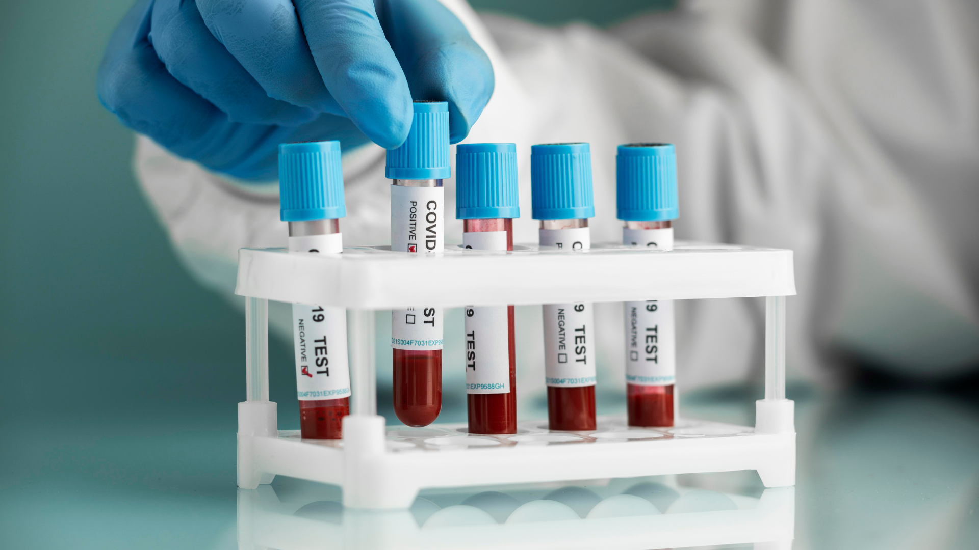 A person is holding a test tube over a rack of test tubes.
