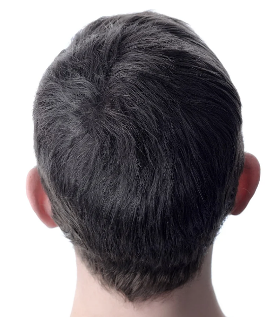 Back of a person's head with short, dark hair and visible ears, against a white background.
