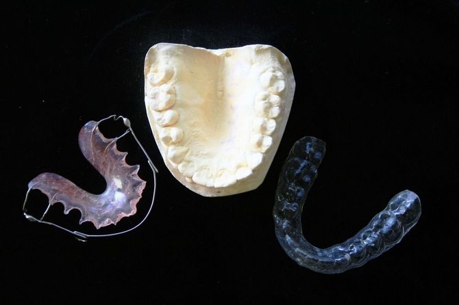 A dental mold of upper teeth with a retainer and mouthguard on a black surface.
