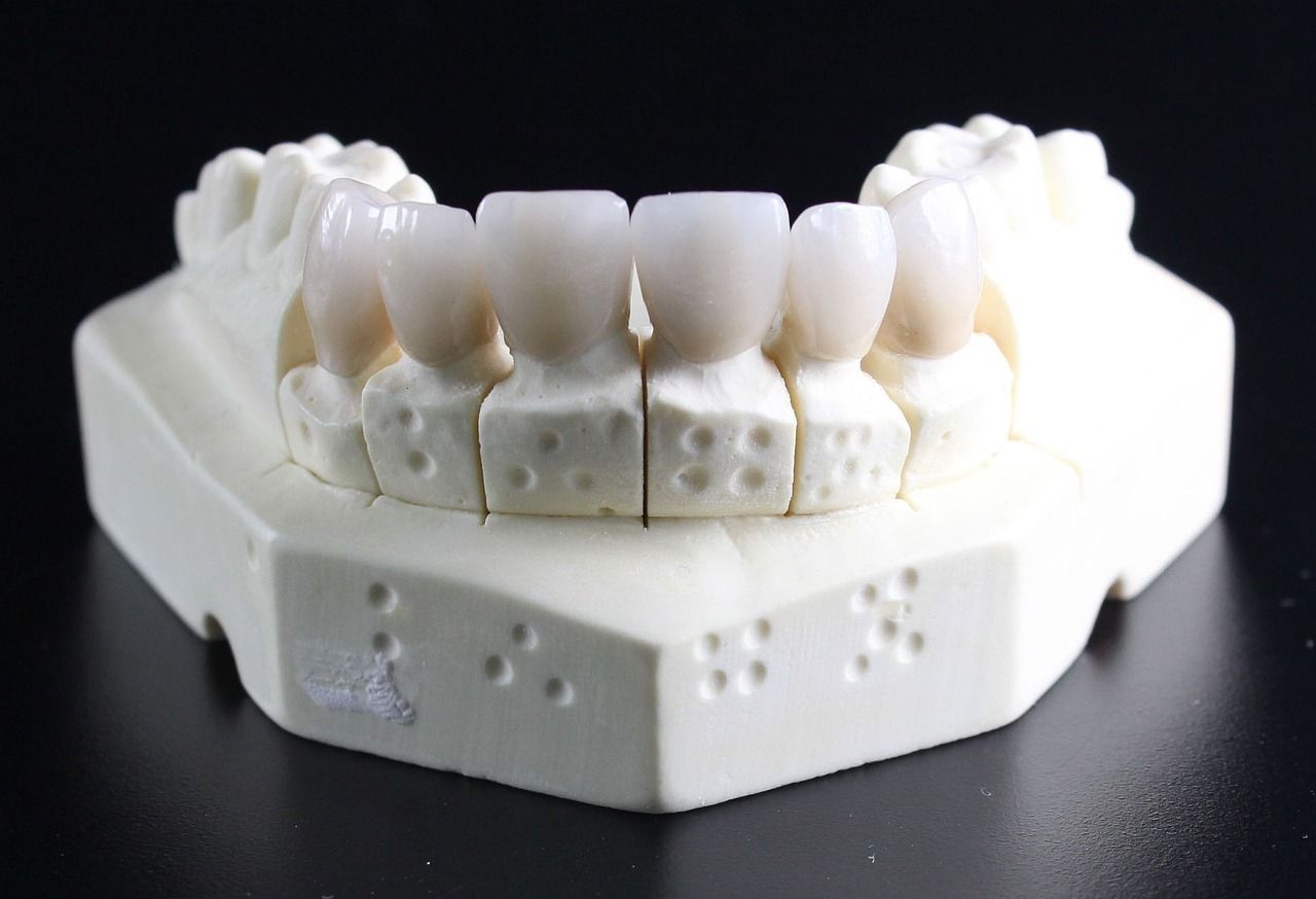 Dental model of teeth with white crowns, on a white cast against a black background.