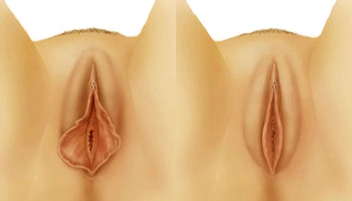 Intymioji chirurgija