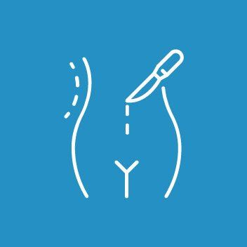 Kūno kontūrų modeliavimas