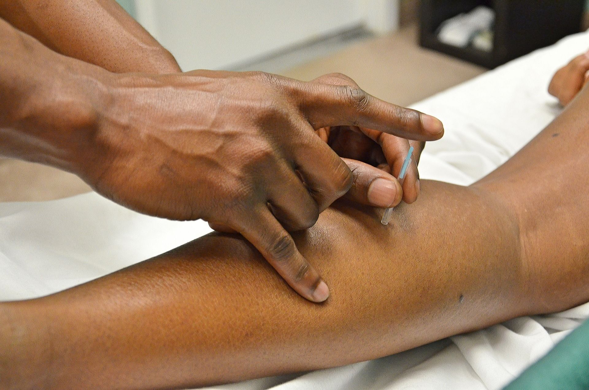 A person is getting an acupuncture treatment on their arm.