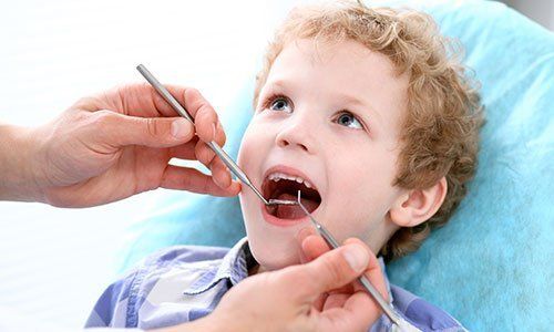 un bambino con capelli ricci biondi con la bocca aperta e due mani di un dentista con rampino e specchietto che gli controllano la bocca