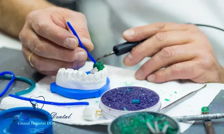 Dentist hands working on a dental mold with wax tools, creating a dental model in a lab setting.