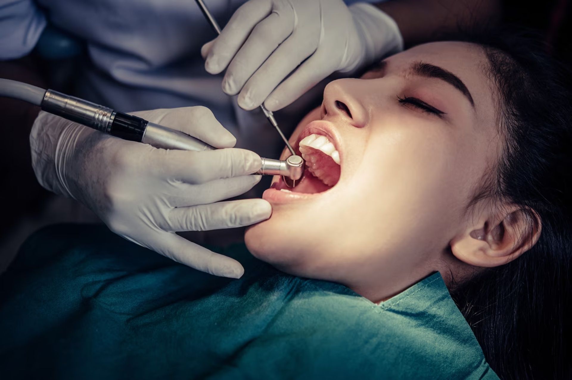 Tooth extractions