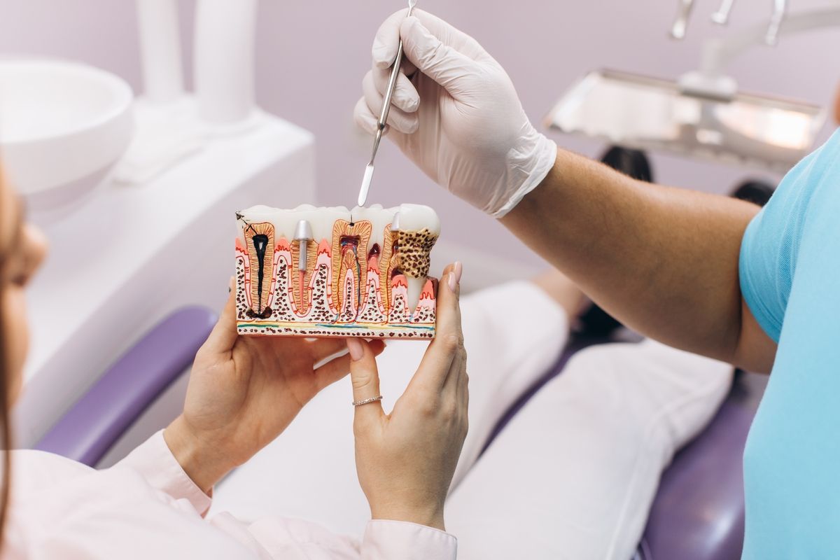 Dentist showing dental implant model to a patient in a treatment room