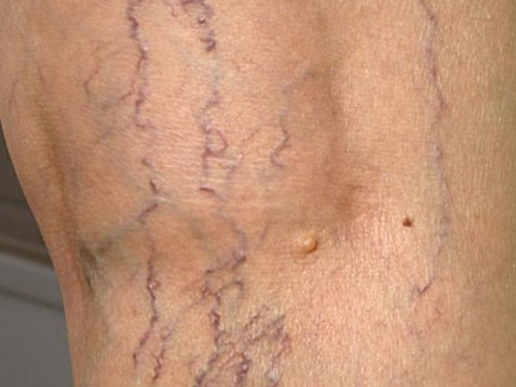 DR. JORGE HALLEY MAURICIO HERNÁNDEZ