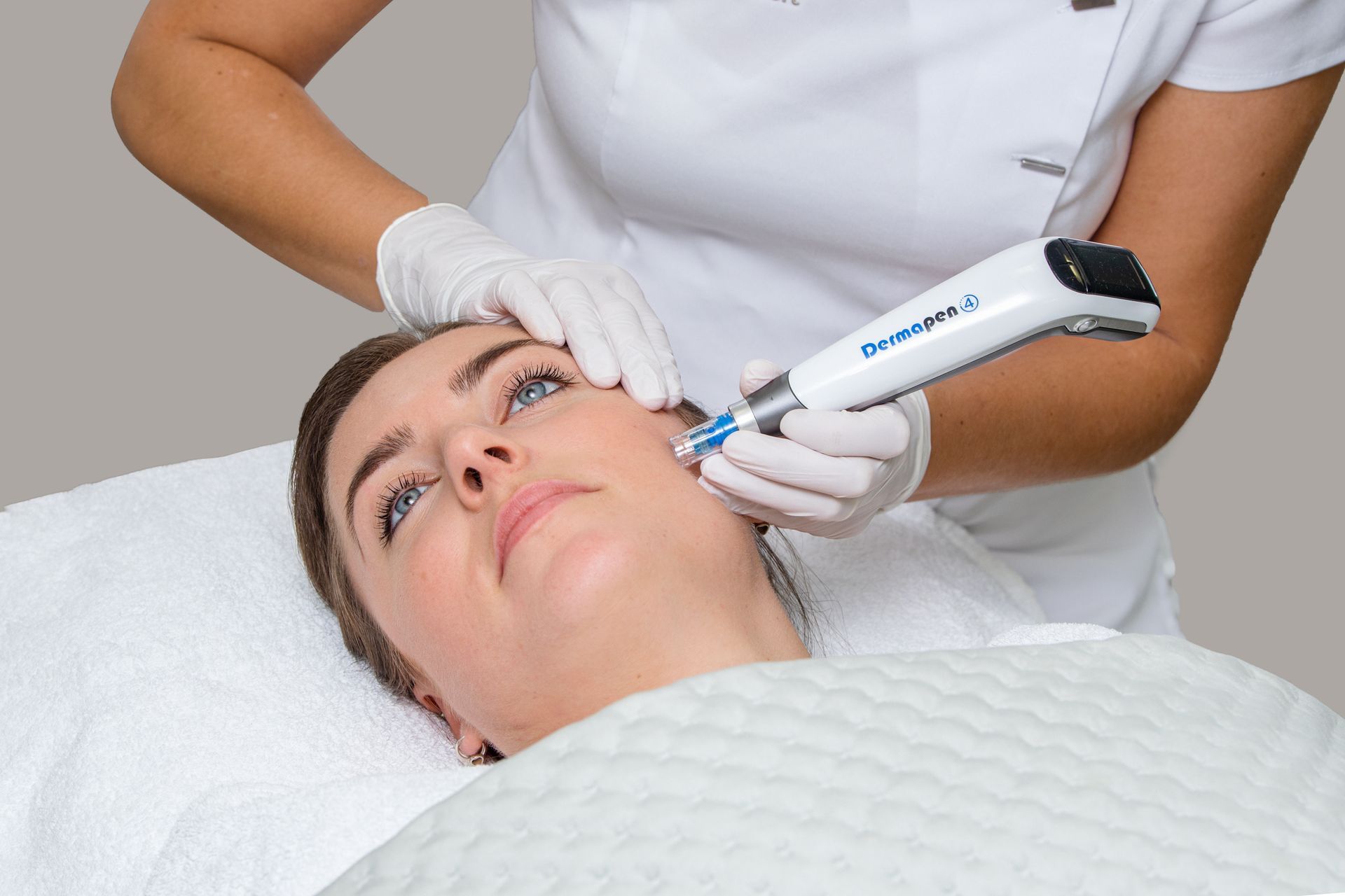 Microneedling
