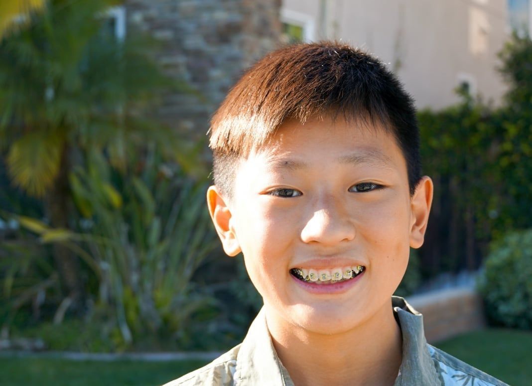 a young boy with braces on his teeth smiles for the camera