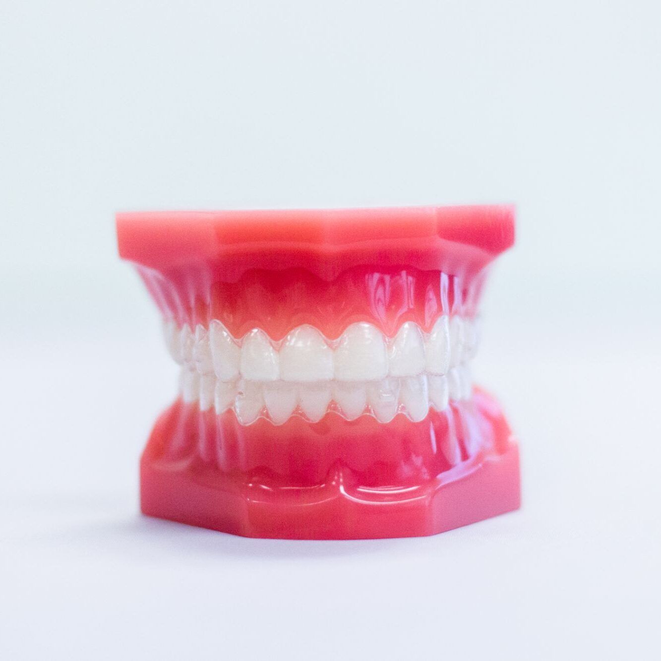 a model of a person 's teeth with white teeth