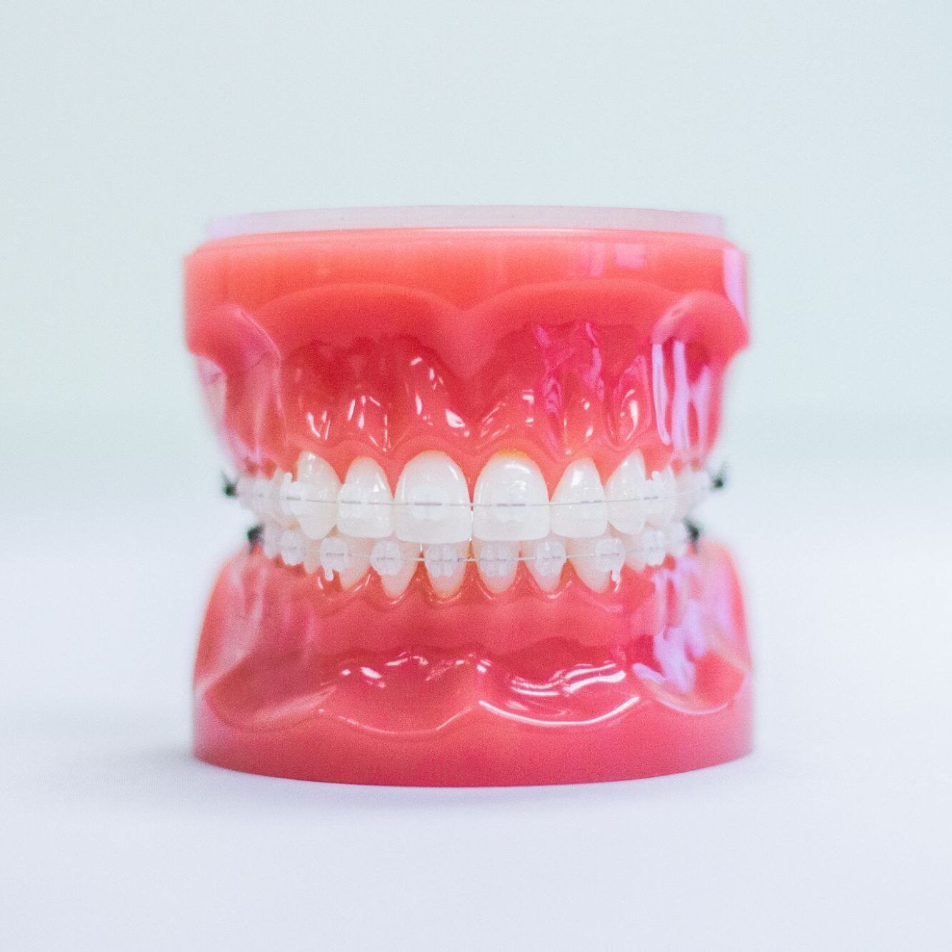 a model of a person 's teeth with braces on them