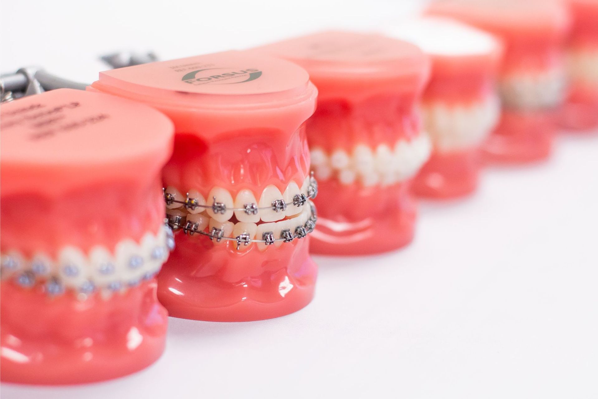 a row of dental models with braces on them
