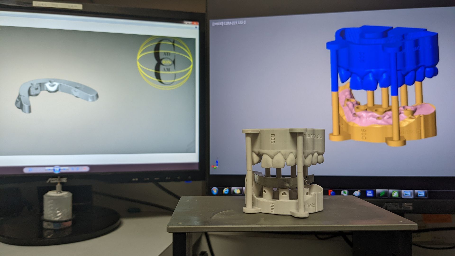 Titanium bar for Hybrid Denture